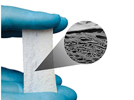 highly porous fish skin used to heal difficult wounds
