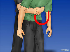Heimlich Maneuver